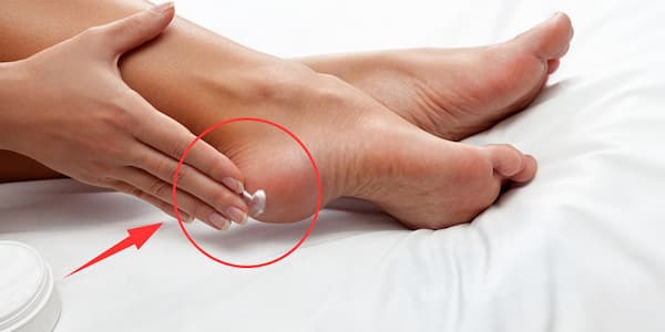 تصویر 1 از فروش کرم ترک دست و پا + قیمت خرید به صرفه